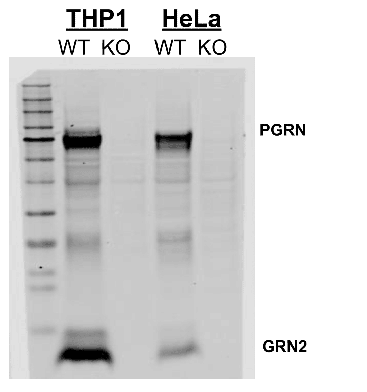 Western blot results for one monoclonal antibody Western blot results for one monoclonal antibody